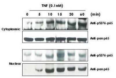 Western Blot: RelA/NFkB p65 [p Ser529] Antibody [NBP1-77808] - TNF Induces phosphorylation of p65 in KBM-5 cells.  Cytoplasmic and nuclear protein lysates prepared after 0, 5, 10, 15, 30 and 60 minutes of 0.1 nM TNF treatment of KBM-5 cells shows inducible phosphorylation using phospho specific polyclonal anti-human pS276 p65.  Pan reactive anti p65 (NBP1-77808) was used a control to show the presence of total p65 in both the cytoplasmic and nuclear extracts.  Phosphorylation of p65 occurs after approximately 10 min of TNF exposure.  Migration of phosphorylated p65 into the nucleus occurs within a similar time frame.   HRP conjugated Gt-anti-Rabbit IgG was used to develop the western blot using a chemi-luminescent detection method.